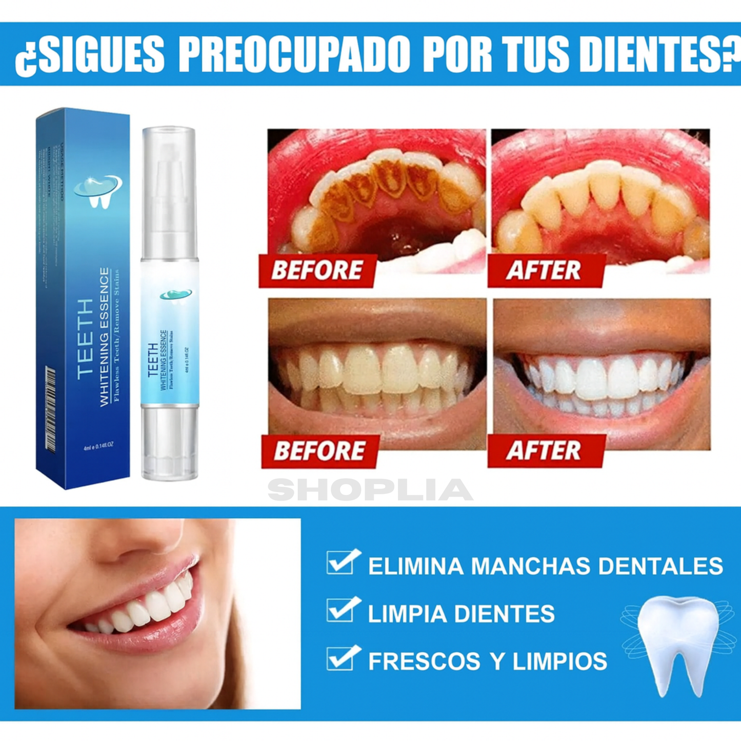 🦷 Lápiz Blanqueador de Dientes 2x1 – ¡Paga 1 y recibe 2!