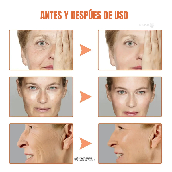 El secreto para una piel joven y radiante – Hyalu B5 Sérum ✨